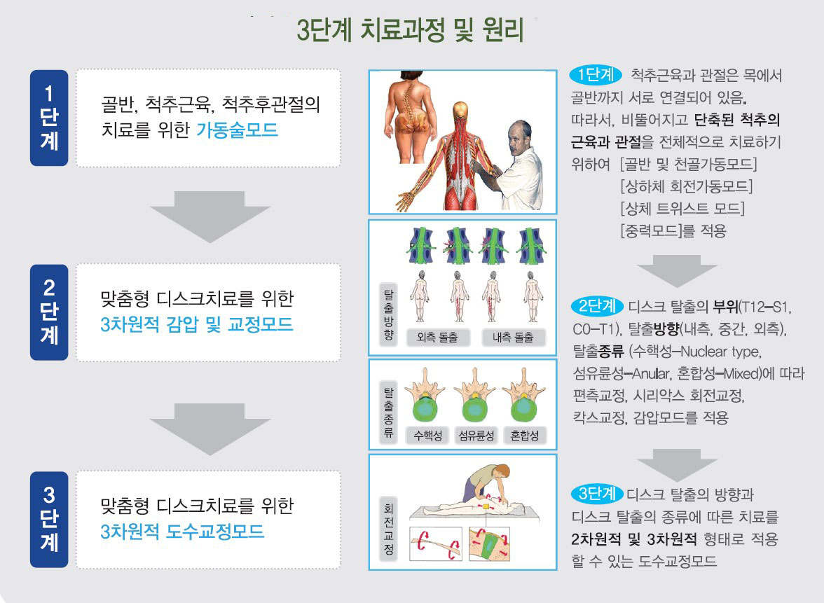 3단계 치료과정 및 원리 1단계 골반, 척추근육, 척추후관절의 치료를 위한 가동술모드 2단계 맞춤형 디스크치료를 위한 3차원적 감압 및 교정모드 3단계 맞춤형 디스크치료를 위한 3차원적 도수교정모드